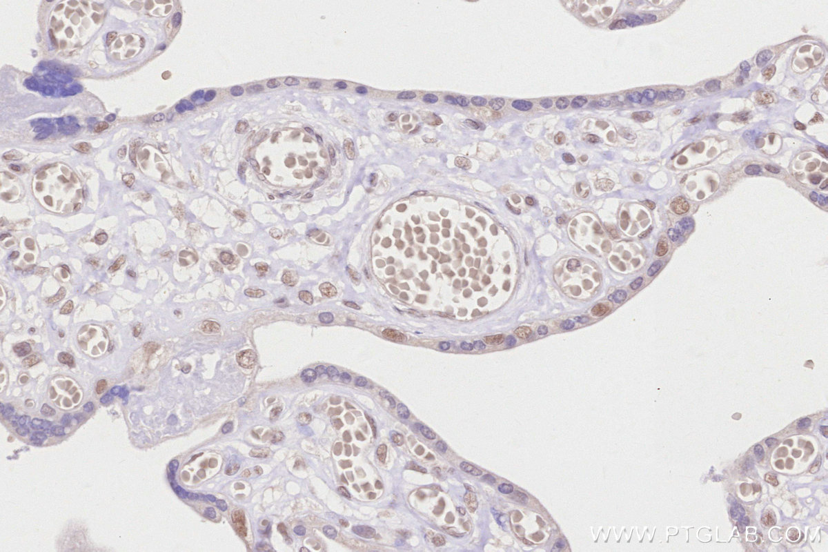Immunohistochemistry (IHC) staining of human placenta tissue using ZNF830 Polyclonal antibody (25618-1-AP)