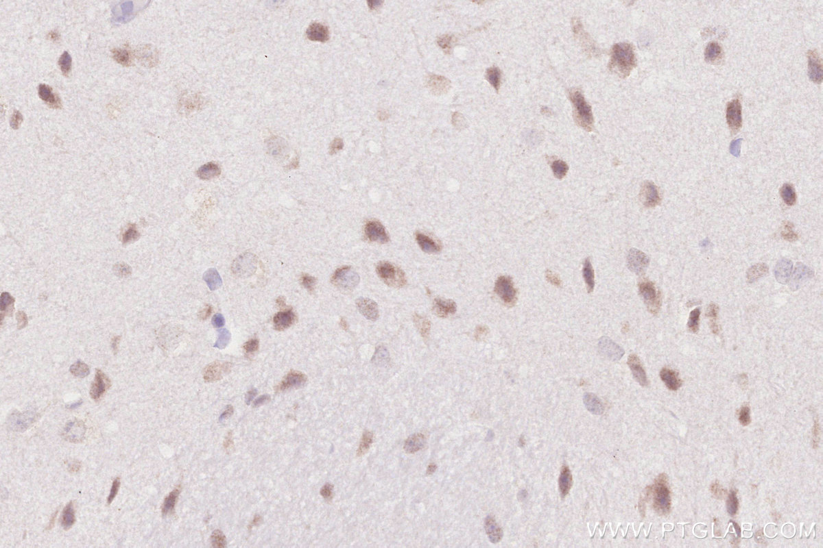 Immunohistochemistry (IHC) staining of mouse brain tissue using ZNF830 Polyclonal antibody (25618-1-AP)