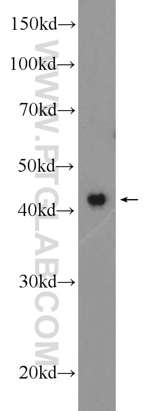 Western Blot (WB) analysis of HeLa cells using ZNF830 Polyclonal antibody (25618-1-AP)