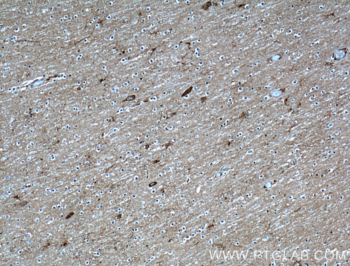 Immunohistochemistry (IHC) staining of human brain tissue using OMG Polyclonal antibody (12701-1-AP)