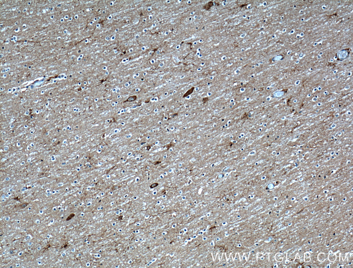 IHC staining of human brain using 12701-1-AP