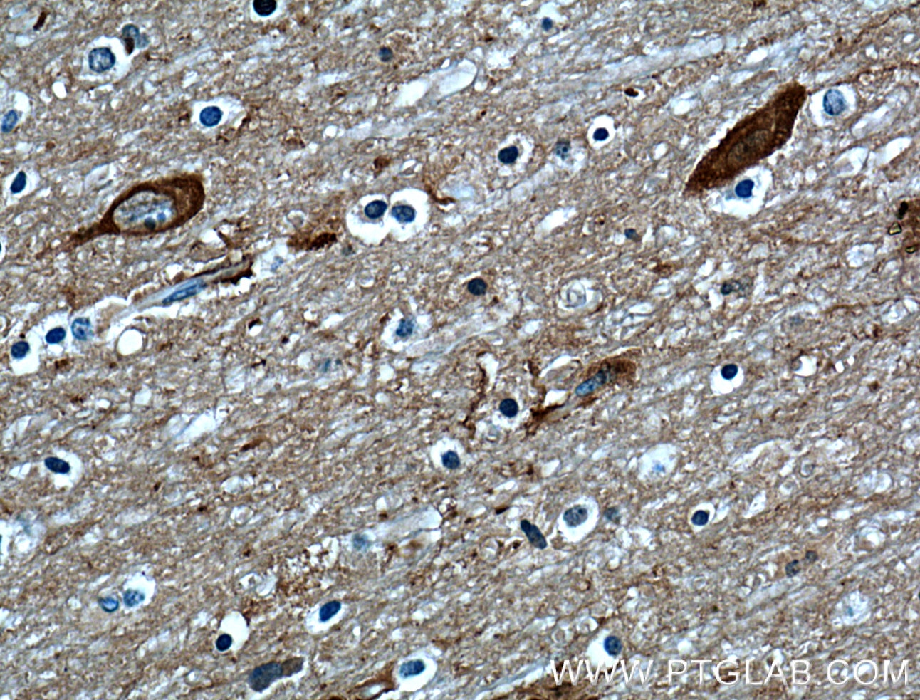 Immunohistochemistry (IHC) staining of human brain tissue using OMG Polyclonal antibody (12701-1-AP)