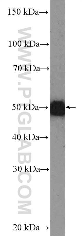 WB analysis of mouse spinal cord using 12701-1-AP