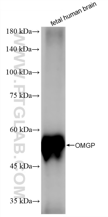 Western Blot (WB) analysis of fetal human brain tissue using OMG Recombinant antibody (86584-1-RR)
