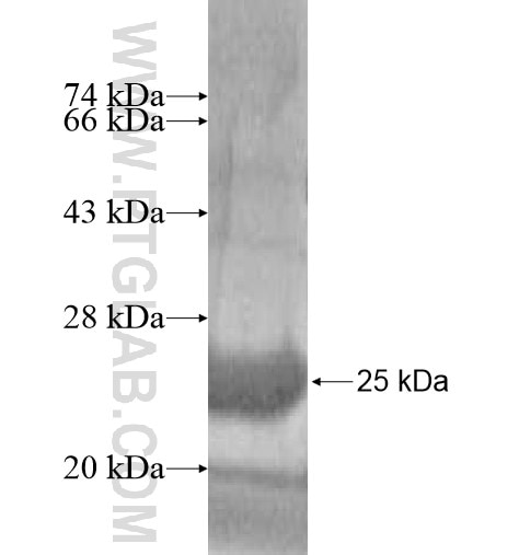 OMP fusion protein Ag12915 SDS-PAGE