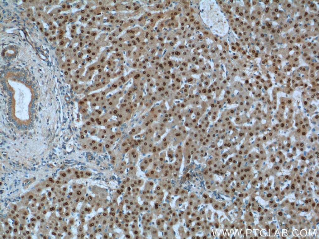 Immunohistochemistry (IHC) staining of human liver tissue using ONECUT1 Polyclonal antibody (25137-1-AP)