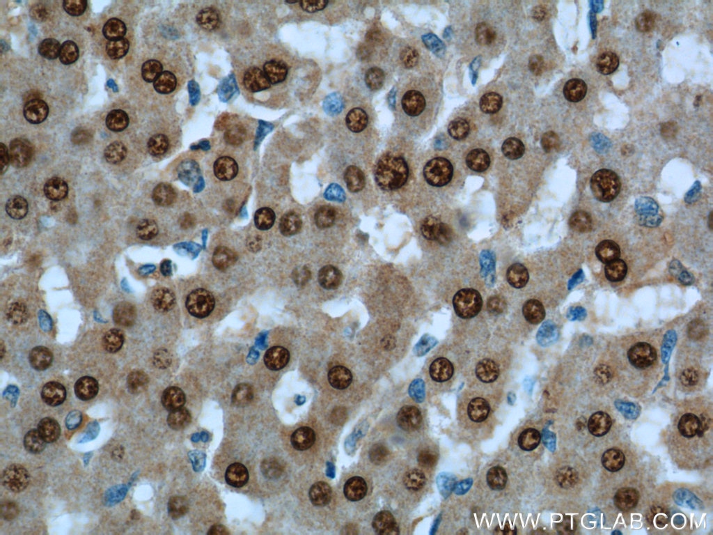 Immunohistochemistry (IHC) staining of human liver tissue using ONECUT1 Polyclonal antibody (25137-1-AP)