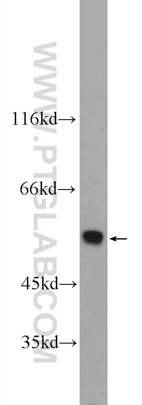 Western Blot (WB) analysis of mouse liver tissue using ONECUT1 Polyclonal antibody (25137-1-AP)