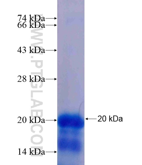 ONECUT1 fusion protein Ag19192 SDS-PAGE