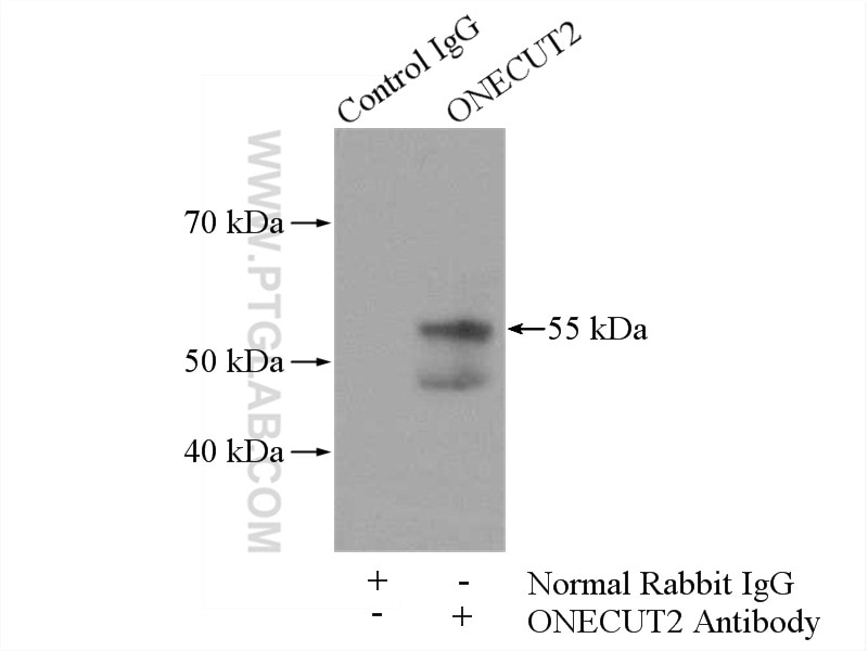 Immunoprecipitation (IP) experiment of HEK-293 cells using ONECUT2 Polyclonal antibody (21916-1-AP)