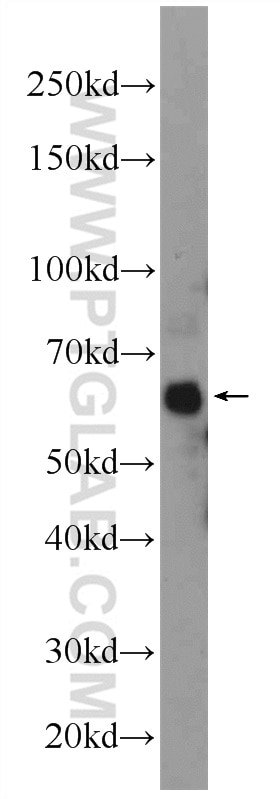 Western Blot (WB) analysis of mouse skin tissue using ONECUT2 Polyclonal antibody (21916-1-AP)