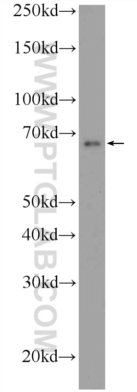 Western Blot (WB) analysis of A549 cells using ONECUT2 Polyclonal antibody (21916-1-AP)