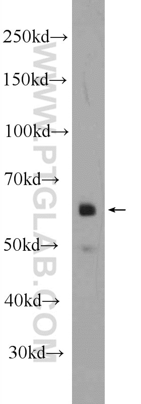 Western Blot (WB) analysis of HEK-293 cells using ONECUT2 Polyclonal antibody (21916-1-AP)