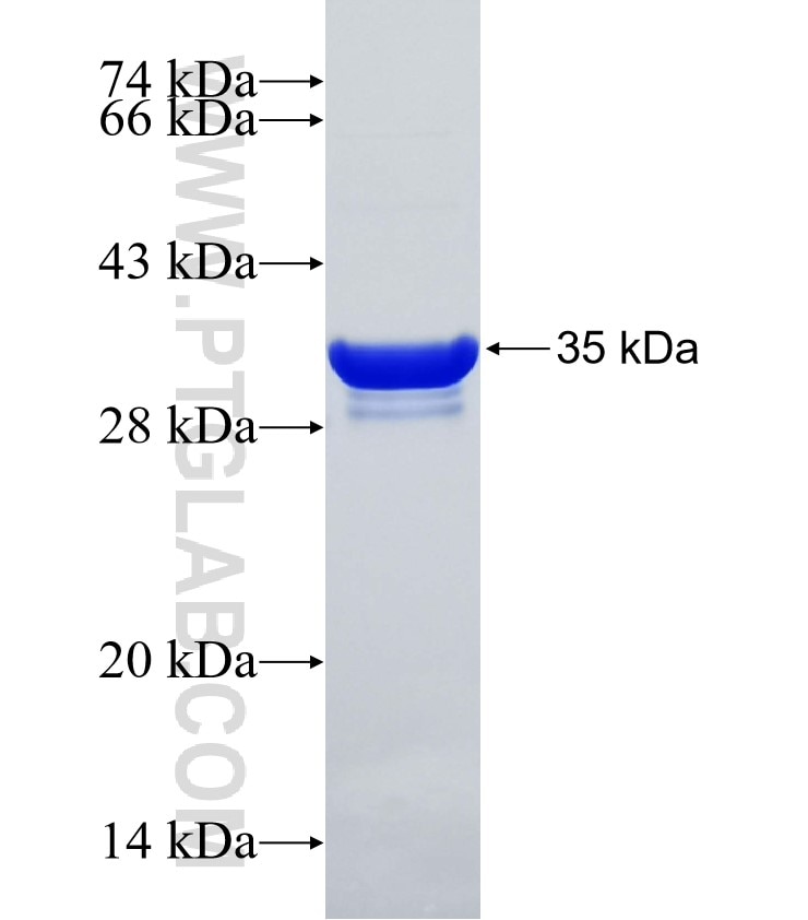 ONECUT2 fusion protein Ag31472 SDS-PAGE ONECUT2 fusion protein Ag31472 SDS-PAGE