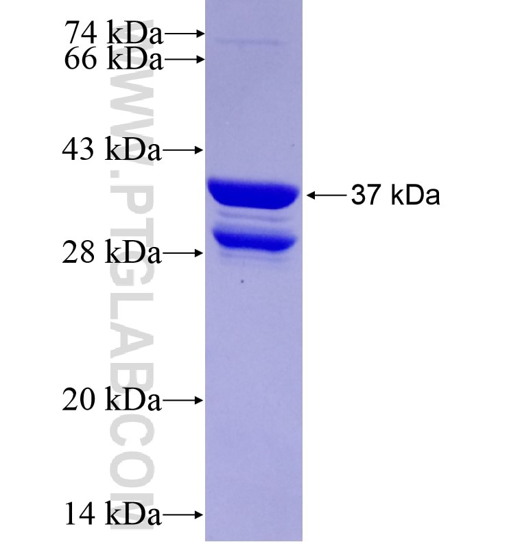 ONECUT2 fusion protein Ag16162 SDS-PAGE