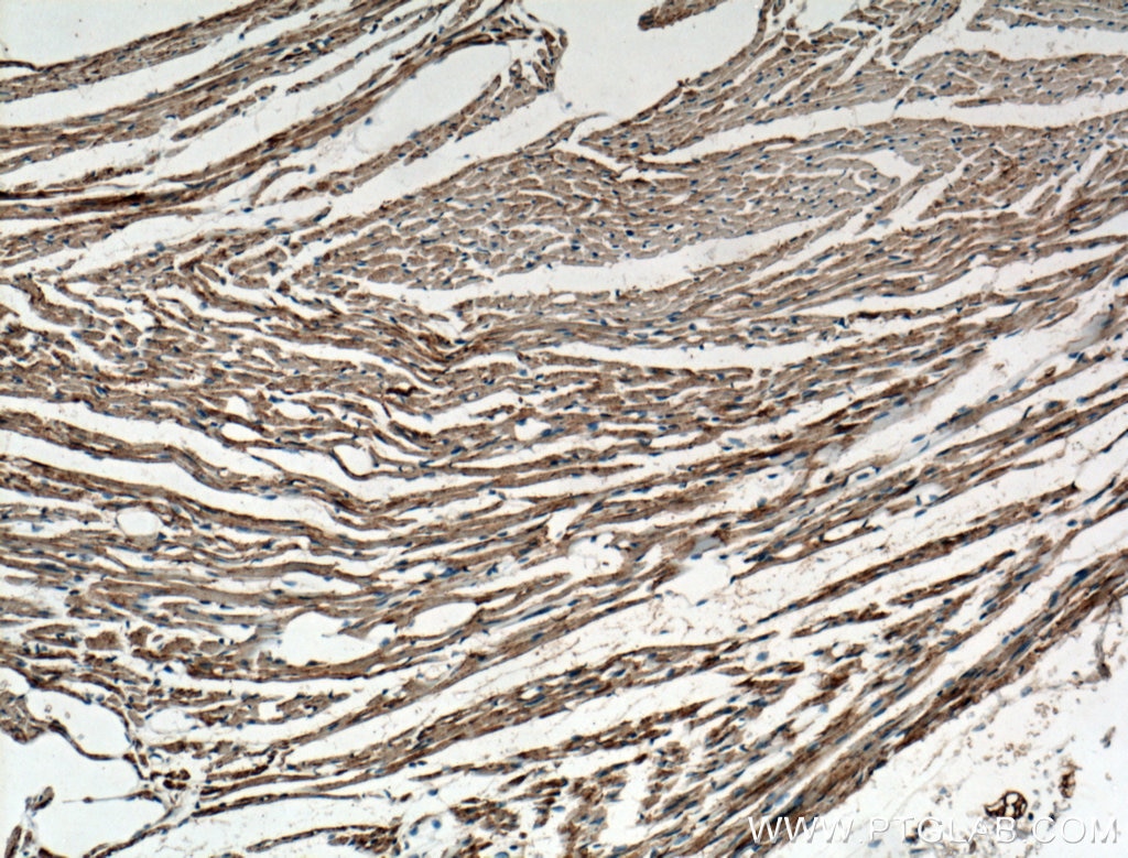 Immunohistochemistry (IHC) staining of mouse heart tissue using OPA1 Polyclonal antibody (27733-1-AP)