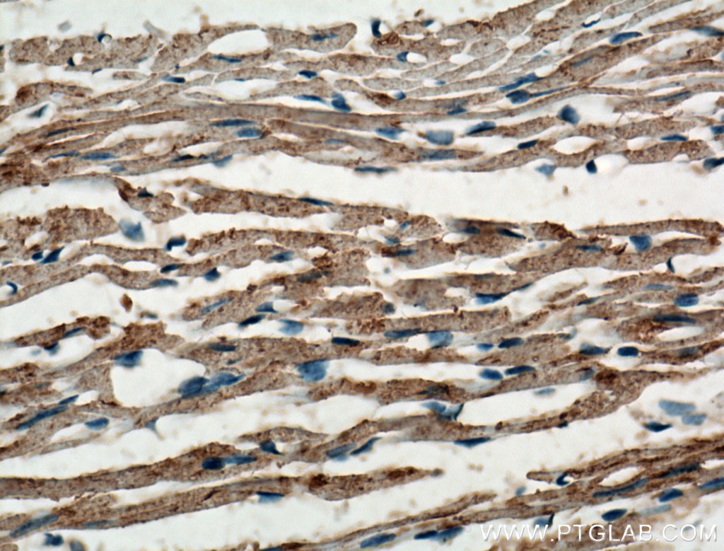 Immunohistochemistry (IHC) staining of mouse heart tissue using OPA1 Polyclonal antibody (27733-1-AP)