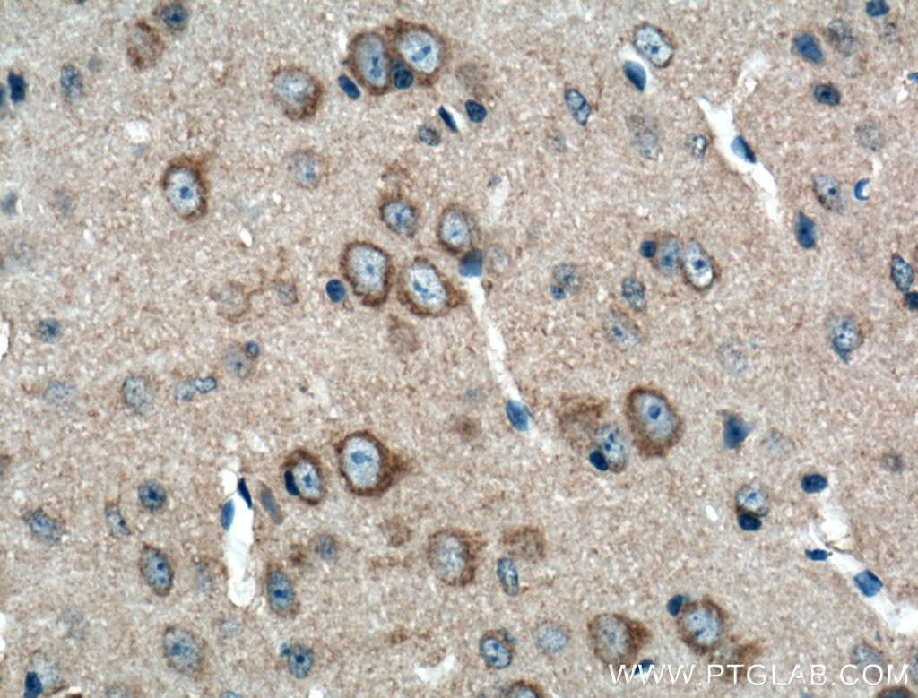 Immunohistochemistry (IHC) staining of mouse brain tissue using OPA1 Polyclonal antibody (27733-1-AP)