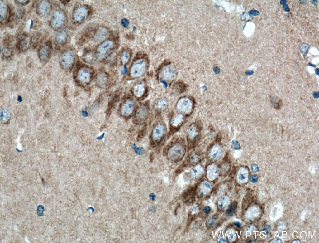 Immunohistochemistry (IHC) staining of mouse brain tissue using OPA1 Polyclonal antibody (27733-1-AP)