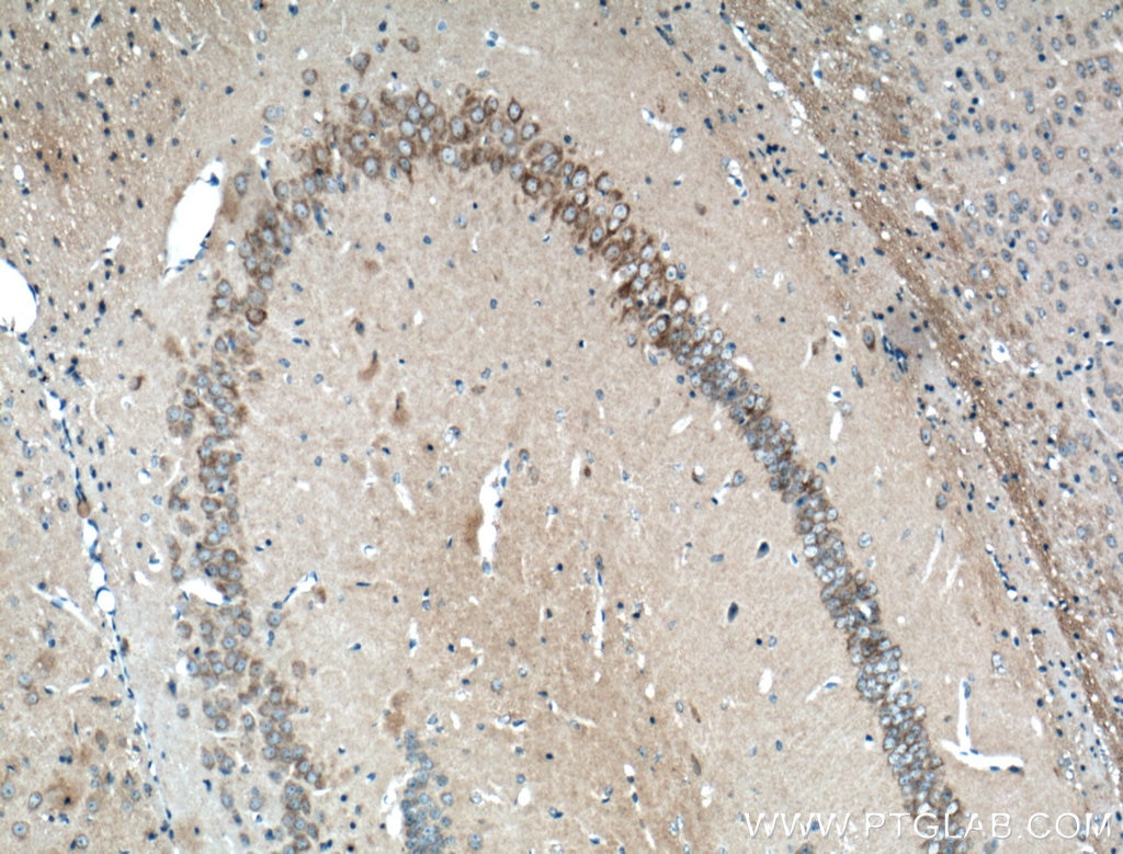 Immunohistochemistry (IHC) staining of mouse brain tissue using OPA1 Polyclonal antibody (27733-1-AP)