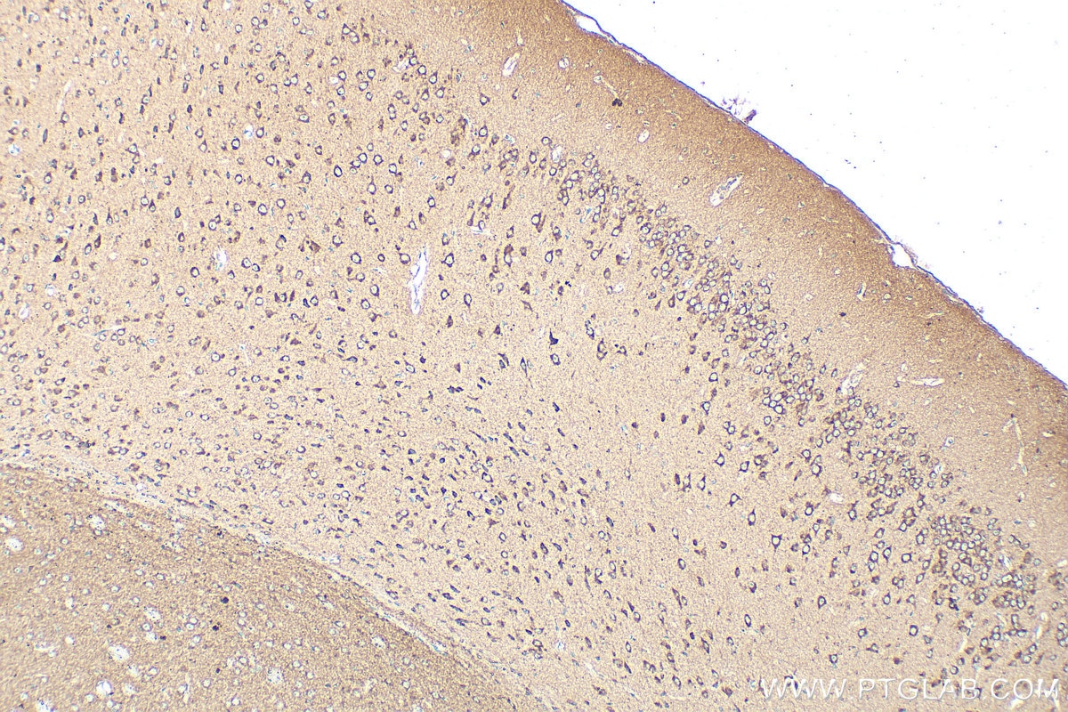 Immunohistochemistry (IHC) staining of mouse brain tissue using OPA1 Polyclonal antibody (27733-1-AP)