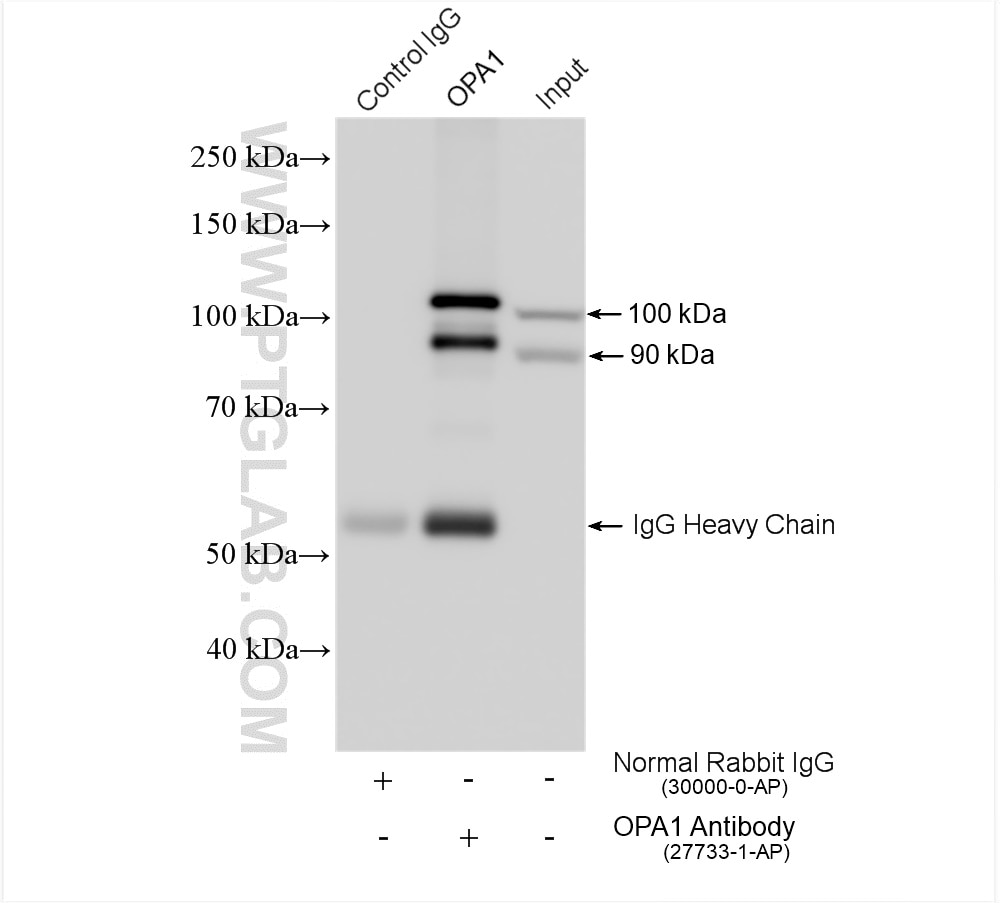 Immunoprecipitation (IP) experiment of mouse brain tissue using OPA1 Polyclonal antibody (27733-1-AP)