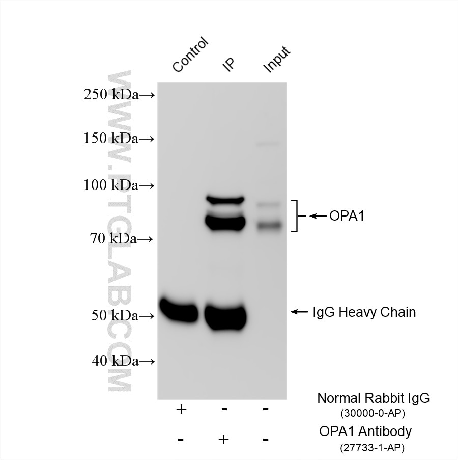IP experiment of mouse brain using 27733-1-AP Immunoprecipitation (IP) experiment of mouse brain tissue using OPA1 Polyclonal antibody (27733-1-AP)