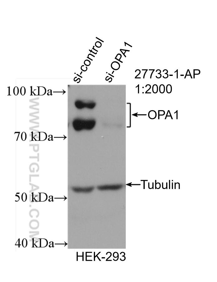 Western Blot (WB) analysis of HEK-293 cells using OPA1 Polyclonal antibody (27733-1-AP)