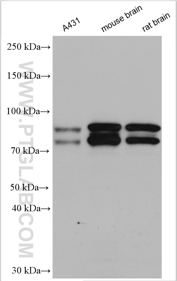 Western Blot (WB) analysis of various lysates using OPA1 Polyclonal antibody (27733-1-AP)