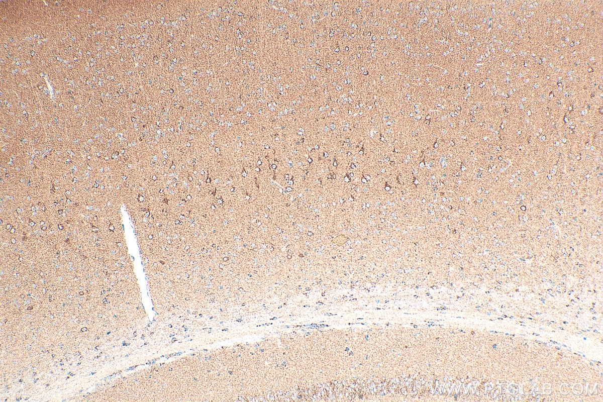 Immunohistochemistry (IHC) staining of mouse brain tissue using OPA1 Polyclonal antibody (32465-1-AP)