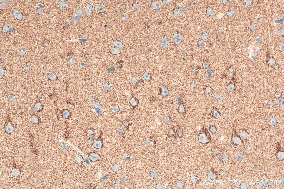 Immunohistochemistry (IHC) staining of mouse brain tissue using OPA1 Polyclonal antibody (32465-1-AP)