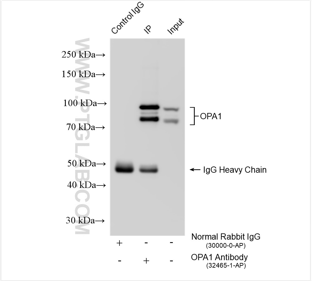 Immunoprecipitation (IP) experiment of mouse brain tissue using OPA1 Polyclonal antibody (32465-1-AP)