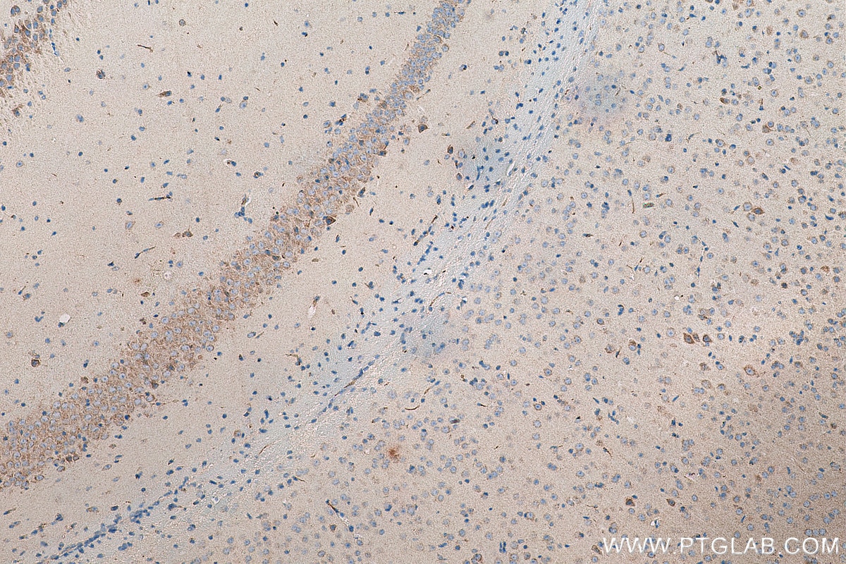 IHC staining of mouse brain using 66583-1-Ig