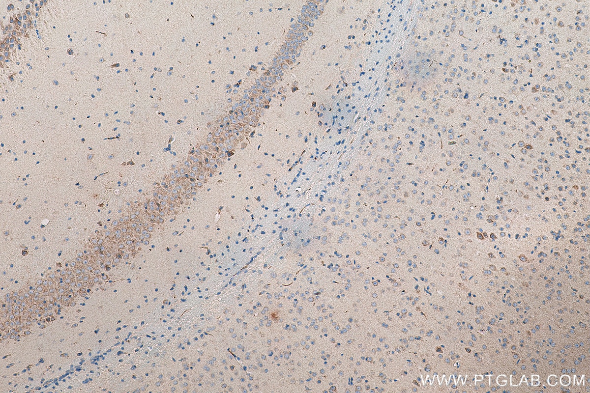 Immunohistochemistry (IHC) staining of mouse brain tissue using OPA1 Monoclonal antibody (66583-1-Ig)