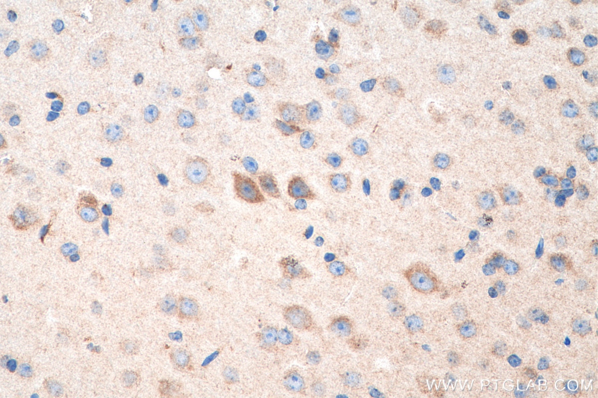Immunohistochemistry (IHC) staining of mouse brain tissue using OPA1 Monoclonal antibody (66583-1-Ig)