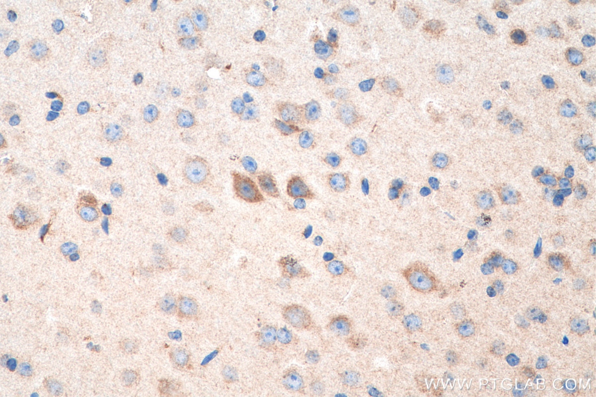 IHC staining of mouse brain using 66583-1-Ig