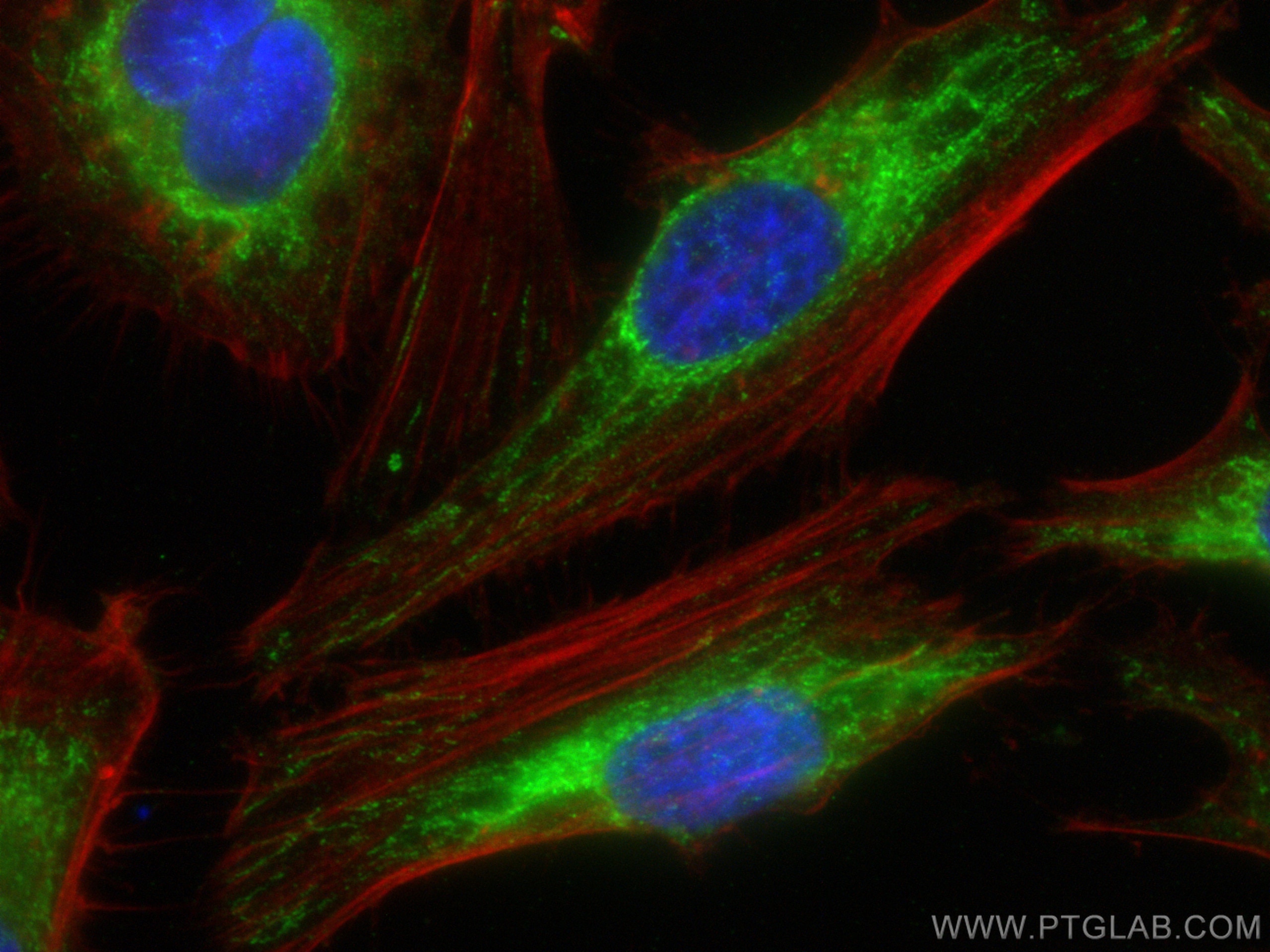 IF Staining of HeLa using 15638-1-AP