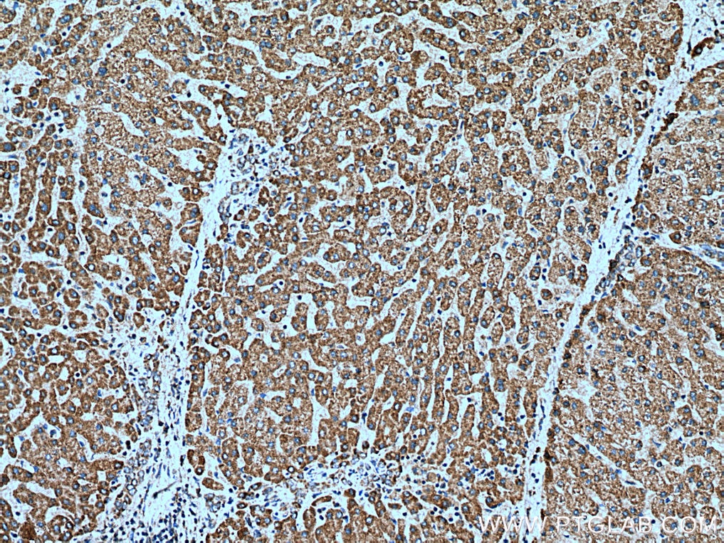 Immunohistochemistry (IHC) staining of human liver tissue using OPA3 Polyclonal antibody (15638-1-AP)