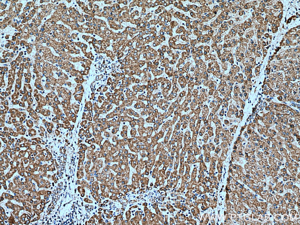 IHC staining of human liver using 15638-1-AP