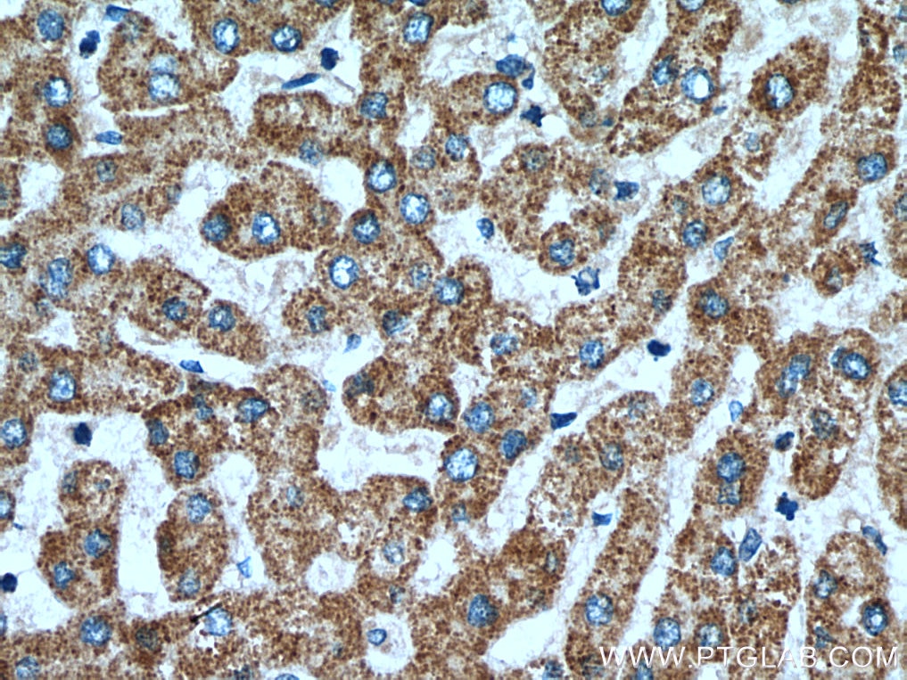 Immunohistochemistry (IHC) staining of human liver tissue using OPA3 Polyclonal antibody (15638-1-AP)