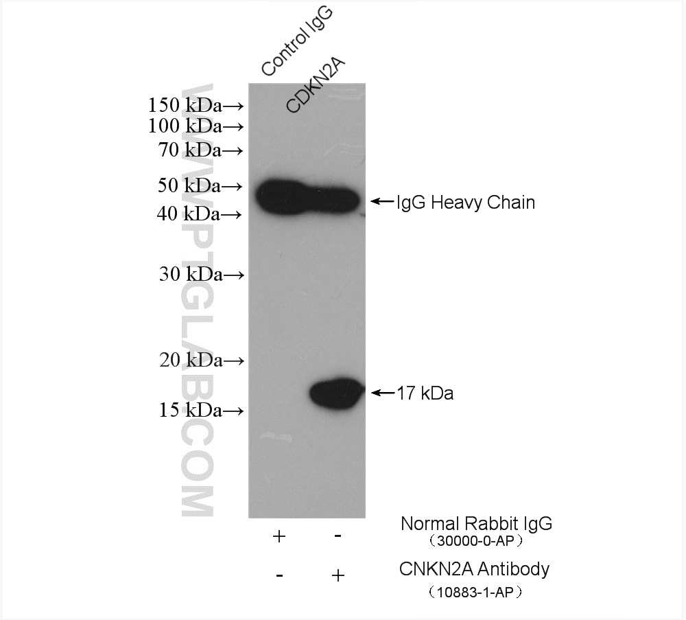 Immunoprecipitation (IP) experiment of HeLa cells using OPA3 Polyclonal antibody (15638-1-AP)