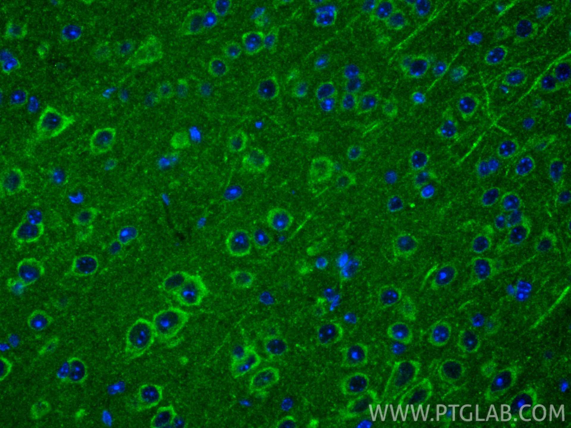 IF Staining of mouse brain using 17962-1-AP Immunofluorescence (IF) / fluorescent staining of mouse brain tissue using OPCML Polyclonal antibody (17962-1-AP)