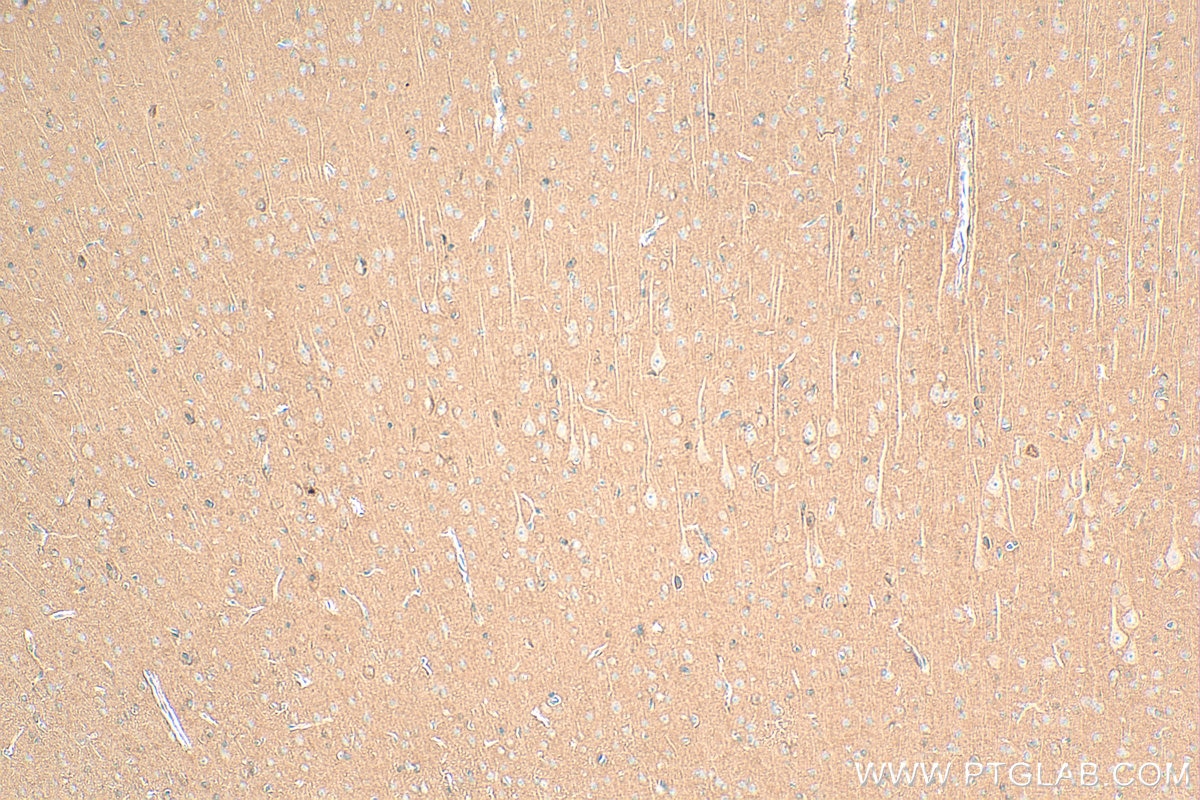 IHC staining of rat brain using 17962-1-AP Immunohistochemistry (IHC) staining of rat brain tissue using OPCML Polyclonal antibody (17962-1-AP)