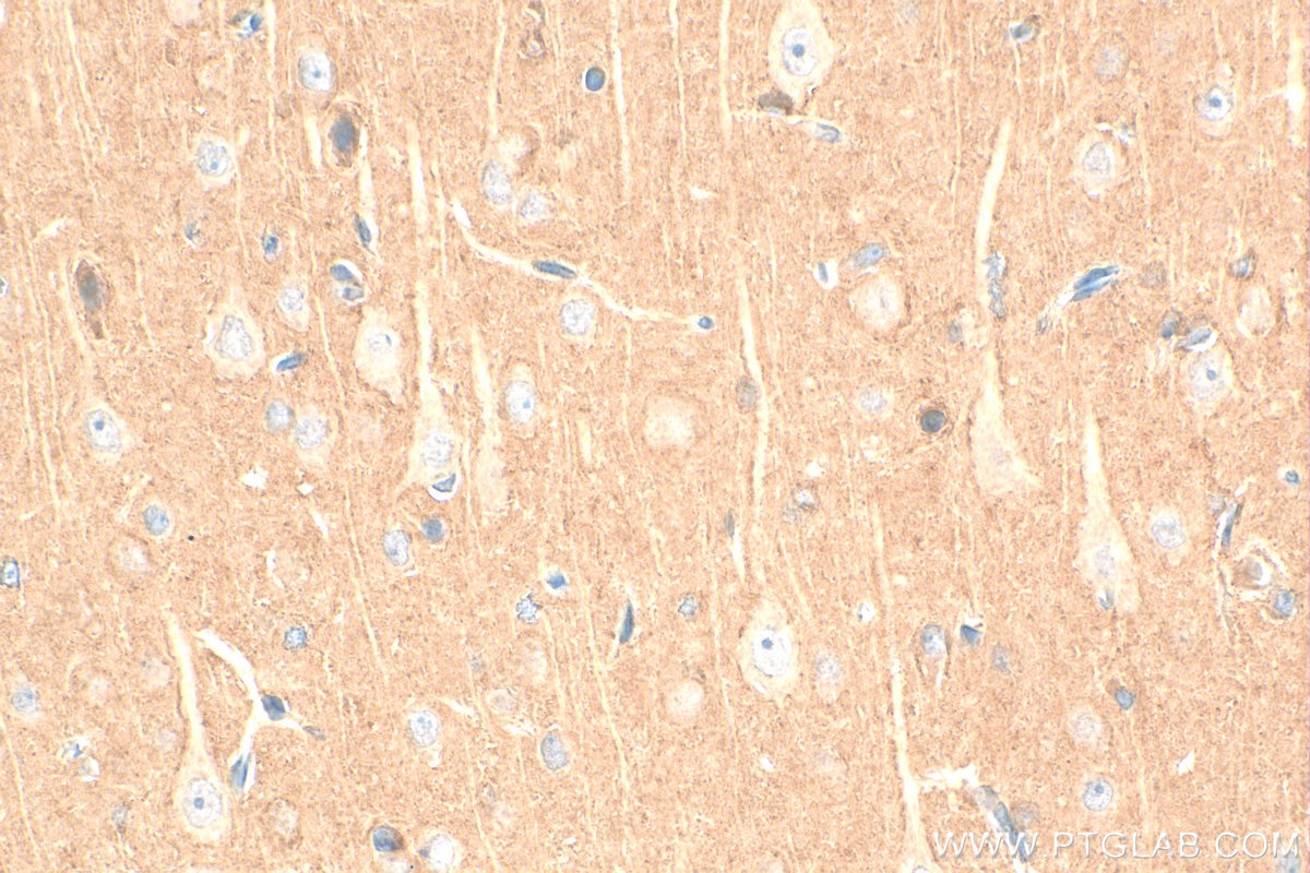IHC staining of rat brain using 17962-1-AP Immunohistochemistry (IHC) staining of rat brain tissue using OPCML Polyclonal antibody (17962-1-AP)