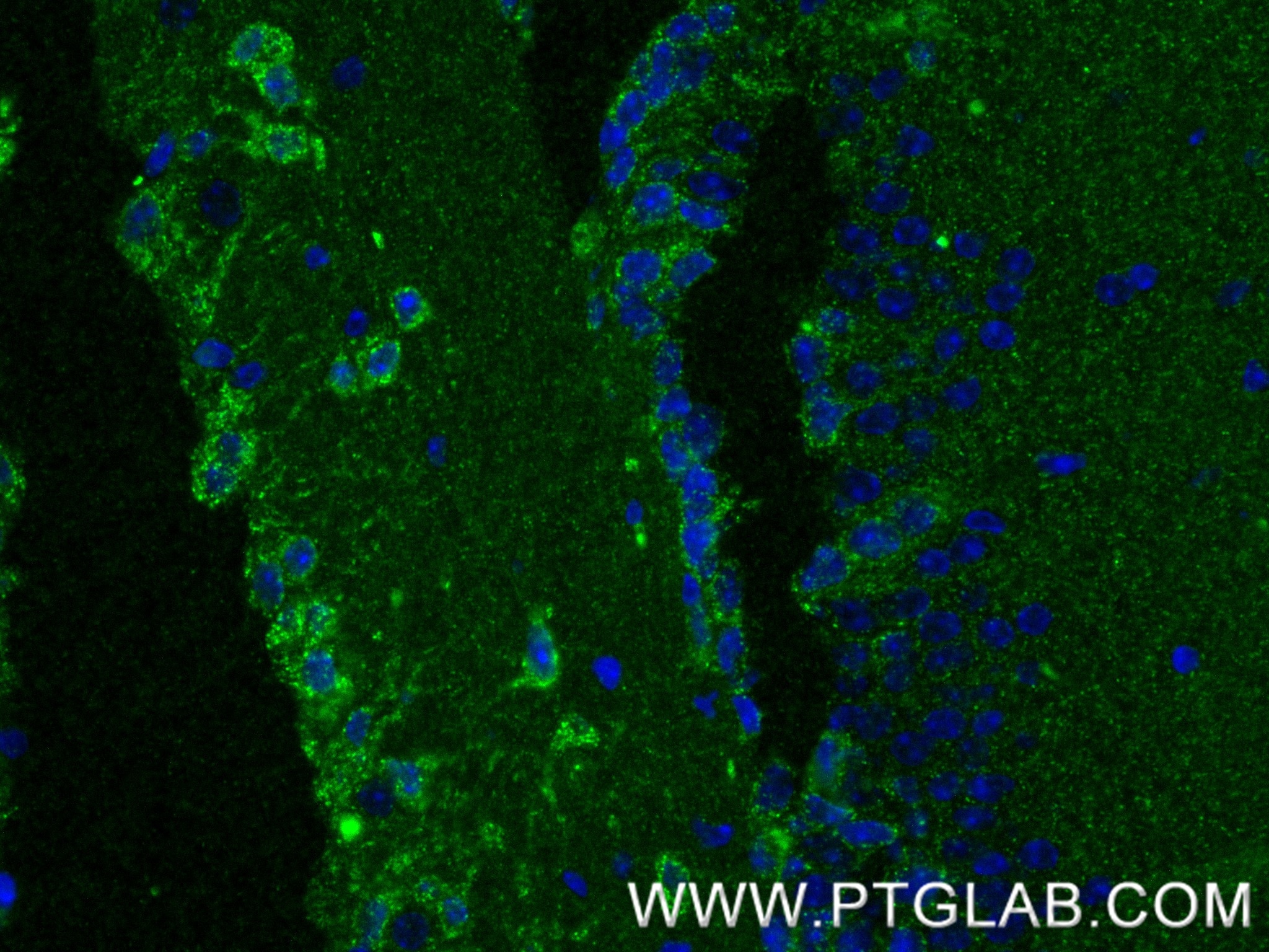 IF Staining of mouse brain using 87815-1-RR Immunofluorescence (IF) / fluorescent staining of mouse brain tissue using OPCML Recombinant monoclonal antibody (87815-1-RR)