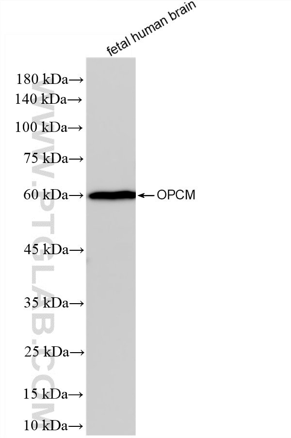 WB analysis of fetal human brain using 87815-1-RR Western Blot (WB) analysis of fetal human brain tissue using OPCML Recombinant monoclonal antibody (87815-1-RR)