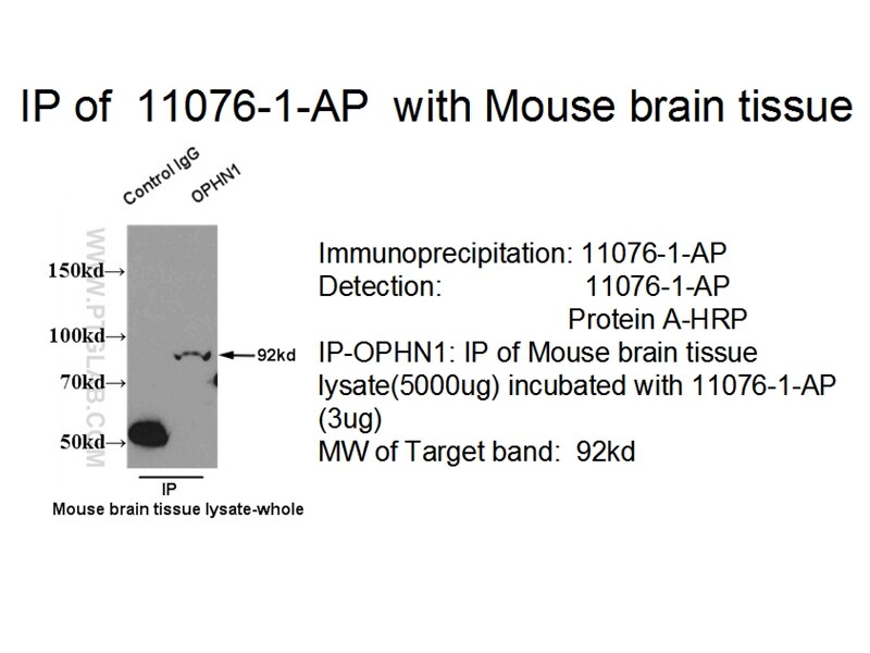 Oligophrenin 1