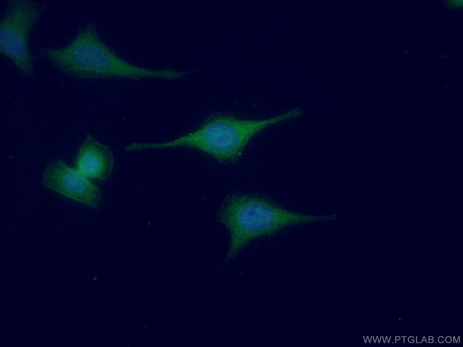 Immunofluorescence (IF) / fluorescent staining of HeLa cells using Oligophrenin 1 Polyclonal antibody (11076-1-AP)