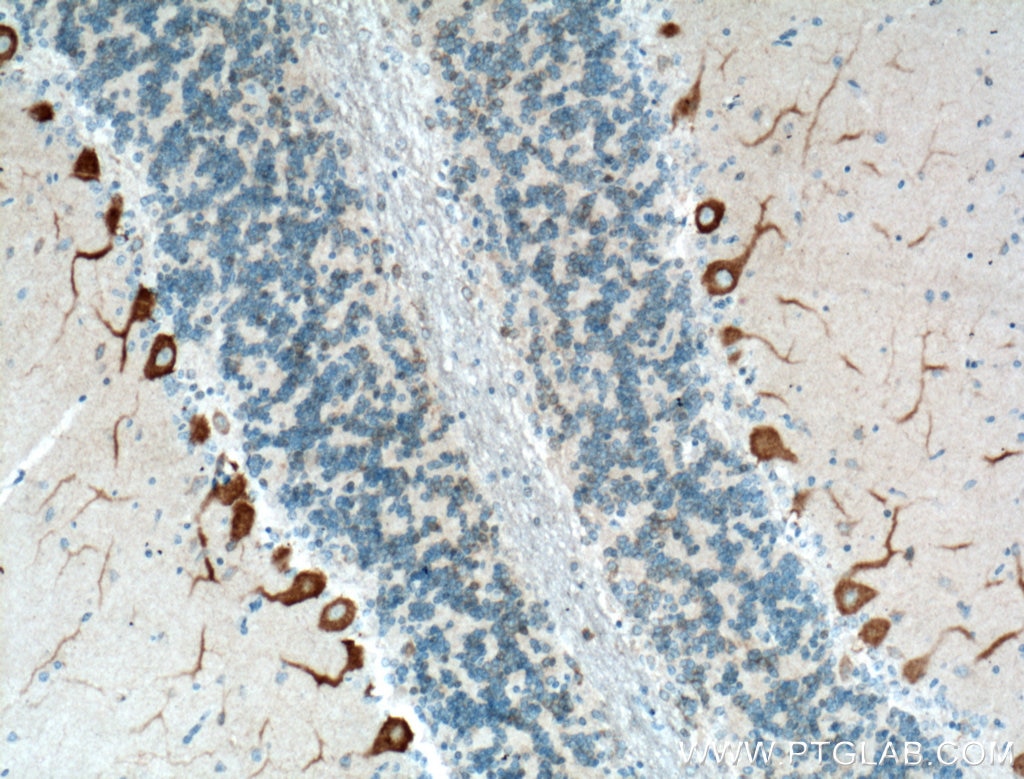 Immunohistochemistry (IHC) staining of human cerebellum tissue using Oligophrenin 1 Polyclonal antibody (11076-1-AP)