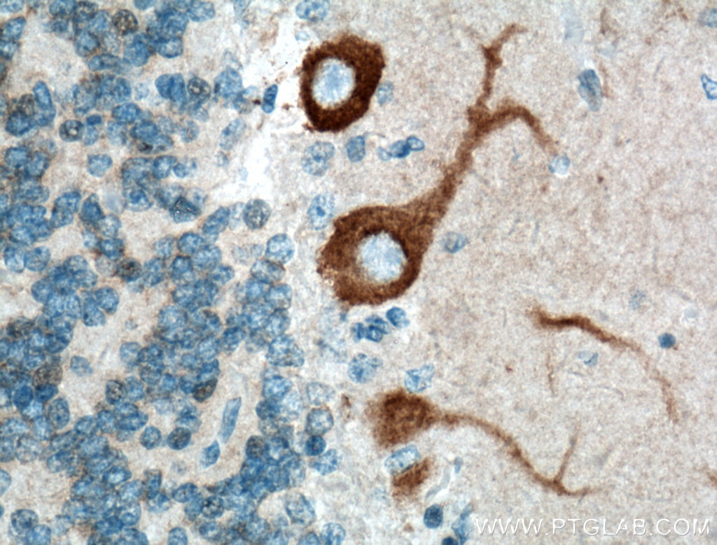 Immunohistochemistry (IHC) staining of human cerebellum tissue using Oligophrenin 1 Polyclonal antibody (11076-1-AP)